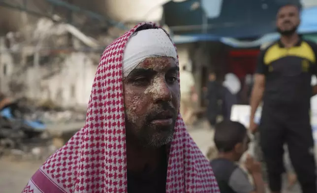 Ahmad al-Dalu, suffering from burns, lost his son, Shaban, in a fire after an Israeli strike hit a tent area in the courtyard of Al Aqsa Martyrs hospital in Deir al-Balah, Gaza Strip, at the site on Wednesday, Oct. 16, 2024. (AP Photo/Abdel Kareem Hana)