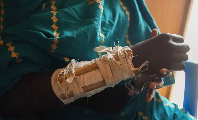 A woman who fled war in Sudan and requested anonymity because she feared retribution after reporting sexual exploitation, holds her injured arm in a refugee camp in Adre, Chad, Thursday, Oct. 3, 2024. (AP Photo/Sam Mednick)