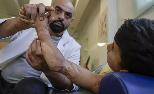 Adam Afana, 5, who was brought to Lebanon from the Strip for treatment after he nearly lost his left arm in an Israeli airstrike that killed his father and sister, receives physiotherapy at a clinic in Mar Elias Palestinian refugee camp in Beirut, Lebanon, Wednesday, Sept. 4, 2024. (AP Photo/Bilal Hussein)