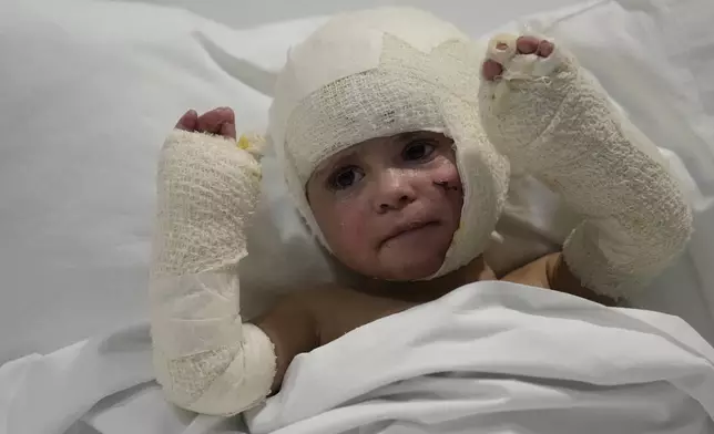 Ivana Skakye, 2, a Lebanese child who is suffering from third-degree burns over 40 percent of her body following an Israeli airstrike last September near their home in Deir Qanoun al Nahr, a village in south Lebanon, raises her burned arms as she lies on a bed at the Geitaoui hospital where she is receiving treatment, in Beirut, Lebanon, Tuesday, Oct. 29, 2024. (AP Photo/Hussein Malla)