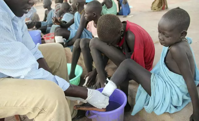 FILE - In this Nov. 4, 2010 photo, Ajak Kuol Nyamchiek, 7, watches while John Lotiki, a nurse with the Carter Center, bandages the blister on her leg from where a guinea worm is slowly emerging in Abuyong, Sudan. (AP Photo/Maggie Fick, File)