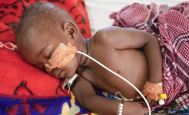 17-month-old Salma IssaAbakar rests in an MSF-run clinic in the Aboutengue displacement site near Acre, Chad, Friday, Oct 4. 2024. (AP Photo/Sam Mednick)