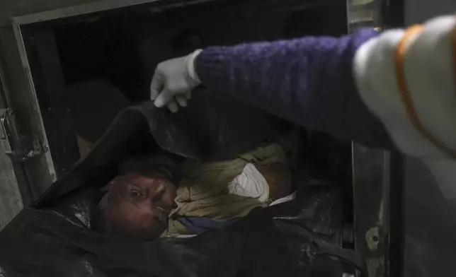 A morgue worker uncovers the body of Syrian activist Mazen al-Hamada before preparing it for burial in Damascus, Thursday, Dec. 12, 2024. Al-Hamad's corpse was found wrapped in a bloody sheet in Saydnaya prison. He had fled to Europe but returned to Syria in 2020 and was imprisoned upon arrival. (AP Photo/Ghaith Alsayed)