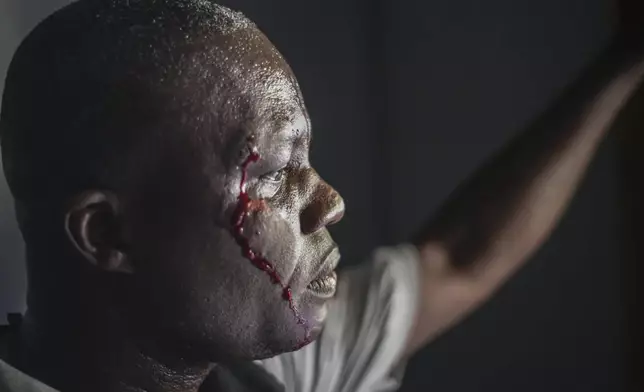 A wounded security officer looks on after being shot by armed gangs at the General Hospital in Port-au-Prince, Haiti, Tuesday, Dec. 24, 2024. (AP Photo/Jean Feguens Regala)