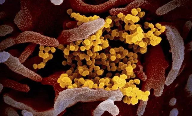 FILE - This undated electron microscope image made available by the U.S. National Institutes of Health in February 2020 shows the Novel Coronavirus SARS-CoV-2, yellow, emerging from the surface of cells, pink, cultured in the lab. Also known as 2019-nCoV, the virus causes COVID-19. The sample was isolated from a patient in the U.S. (NIAID-RML via AP, File)