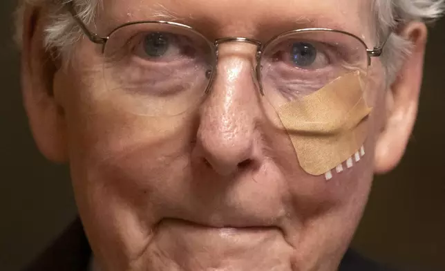 FILE - Senate Minority Leader Mitch McConnell of Ky. wears a bandage on his face as he walks to cast a vote on the Senate floor after falling during a luncheon on Capitol Hill, Dec. 10, 2024, in Washington. (AP Photo/Mark Schiefelbein, File)