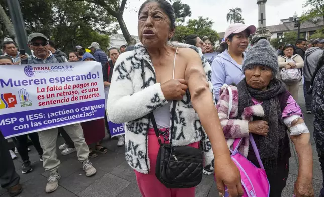 Maria Sambueza shows her arm affected by years of dialysis during a protest by people with kidney deficiencies outside Carondelet presidential palace as they demand the government pay overdue debts to private clinics so they can continue to get free dialysis in Quito, Ecuador, Friday, Feb. 21, 2025. The sign at left reads in Spanish, "They die waiting! The lack of payment isn't a delay, it's a death sentence." (AP Photo/Dolores Ochoa)