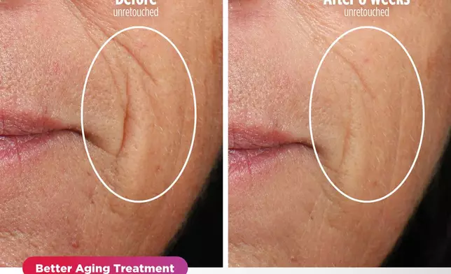 Shark™ CryoGlow™ is a MedSpa-inspired under-eye cooling + LED anti-aging &amp; acne clearing mask combining high-energy LEDs, deep-penetrating infrared, and under-eye cooling all available with the touch of a button. (Photo: Business Wire)