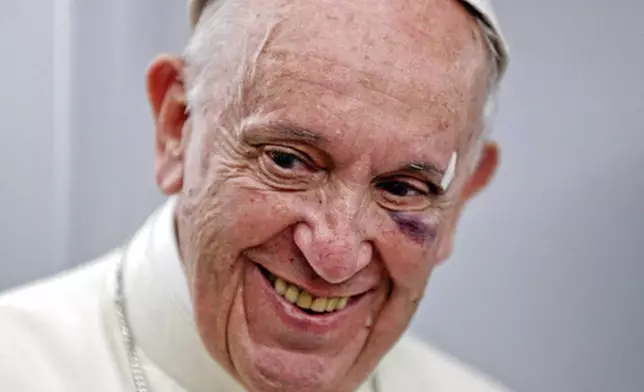 FILE - Pope Francis wears a plaster and has a bruised, black left eye and a cut on his eyebrow as he talks to journalists during a press conference on board the flight to Rome, at the end of a five-day visit to Colombia, where he banged his head on his popemobile when it stopped short amid swarms of well-wishers and he lost his balance, having only had a hip-high bar to hold onto, Monday, Sept. 11, 2017. (AP Photo/Andrew Medichini, pool, file)