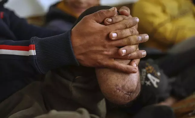 Shepherd Jalal Ma'rouf, 22, rests his hands on the stump of the limb he lost to a landmine while herding sheep in farmland recently recaptured from regime forces, at his home in Deir Sunbul village, south of Idlib, Wednesday, April 9, 2025. (AP Photo/Ghaith Alsayed)