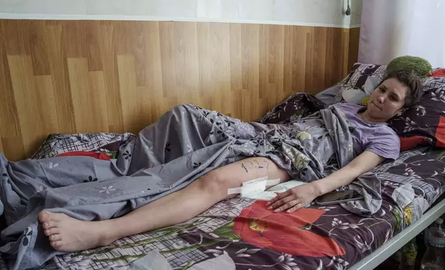 Asia Pohorila, 20, injured in a deadly Palm Sunday Russian attack on Sumy on April 13, lies on a bed at a hospital in Sumy, Ukraine, Tuesday, April 15, 2025. (AP Photo/Evgeniy Maloletka)