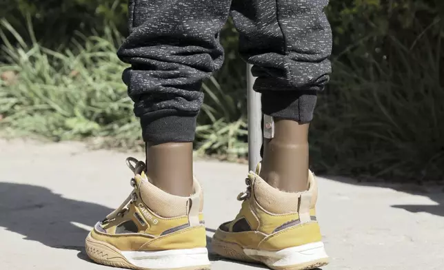 A young boy who lost his leg during the recent war walks with his mother during a visit at Ortho-Physiotherapy Centre in Mekele, Tigray region of northern Ethiopia Friday, Feb. 14, 2025. (AP Photo/Amanuel Birhane)