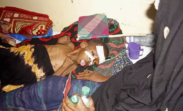 A woman checks on her malnourished child at Banadir Hospital in Mogadishu, Somalia, Wednesday, May 14, 2025. (AP Photo/Farah Abdi Warsameh)
