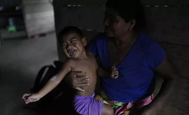 Flor Maria Guainora holds her grandson who cries due to a skin rash in Villa Caleta, a community in Panama once traversed by hundreds of thousands of migrants on their way to the United States, Monday, April 7, 2025. (AP Photo/Matias Delacroix)