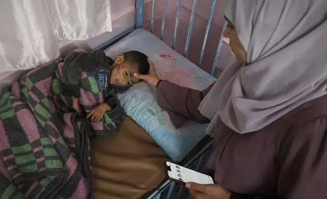 Mona al-Raqab cares for her son Osama, 5, which she says his cystic fibrosis has worsened since the start of the war due to the lack of meat, fish and enzyme tablets to help him digest food, at a malnutrition clinic in Nasser hospital, Khan Younis, Gaza Strip, Thursday, May 1, 2025. (AP Photo/Abdel Kareem Hana)