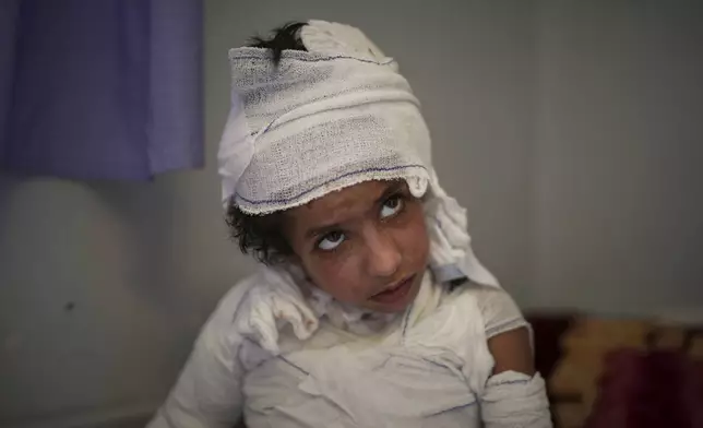 Hamza Abu Shabab, 7, sits in bed with third-degree burns caused when, frightened by an Israeli airstrike, he spilled a hot plate of rice and lentils on himself in the family's tent in southern Gaza last month, at Nasser hospital in Khan Younis, Gaza Strip, Sunday, May 4, 2025.(AP Photo/Abdel Kareem Hana)
