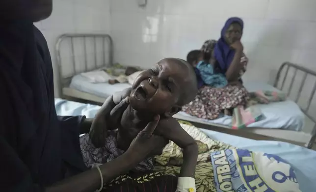 A sick child cries at the Intersos facility, an Italian humanitarian organization, the only remaining facility providing in-patient services for malnutrition in Dikwa, northeastern, Nigeria, Tuesday, April 29, 2025. (AP Photo/Sunday Alamba)
