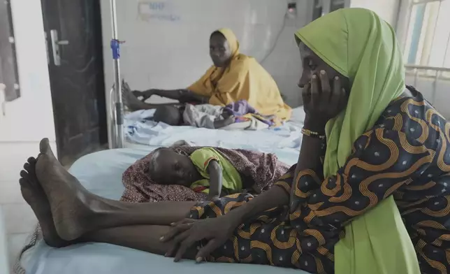 A malnourished child received treatment at the Intersos facility, an Italian humanitarian organization, the only remaining facility providing in-patient services for malnutrition in Dikwa, northeastern, Nigeria, Tuesday, April 29, 2025. (AP Photo/Sunday Alamba)