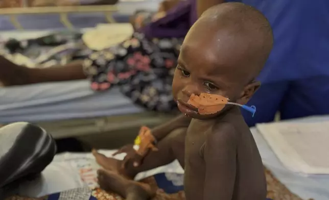A Malnourished child receives treatment at the Intersos facility, an Italian humanitarian organization, the only remaining facility providing in-patient services for malnutrition in Maiduguri, northeastern, Nigeria, Thursday, May 1, 2025. (AP Photo/Sunday Alamba)