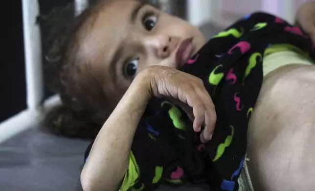 Mayar Al-Arja, 2, who suffers from malnutrition, lies on a bed in a clinic in Nasser hospital, Khan Younis, Gaza, Wednesday, May 21, 2025. (AP Photo/Abdel Kareem Hana)