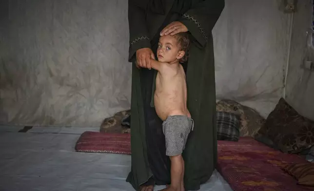 Mohammed Abu Hilal, 2, clings to his mother, Yasmine, inside their tent at the Muwasi camp for displaced Palestinians in Khan Younis, southern Gaza Strip, Sunday, May 18, 2025. (AP Photo/Abdel Kareem Hana)