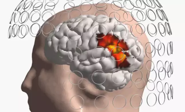 The resulting functional brain image as shown by CURRY software.