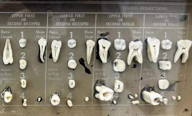 Dissected human teeth are displayed in the office of dentist Dr. James Bekker, April 30, 2025, in Salt Lake City, Utah. (AP Photo/Hannah Schoenbaum)