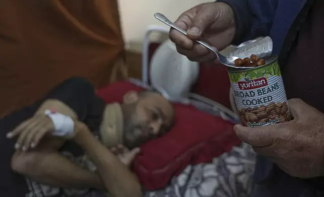Sobhi al-Bursh, who was injured in a bombing and lost his foot, is fed beans brought from home by his father, Mohamed, at Nasser Hospital in Khan Younis, Gaza Strip, Tuesday, May 6, 2025. (AP Photo/Abdel Kareem Hana)