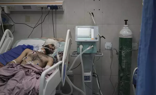 Mahmoud Al-Beyram, who was injured in the head when his family home was targeted in an Israeli army strike, lies in bed in the intensive care unit at Nasser Hospital in Khan Younis, Gaza Strip, Tuesday, May 6, 2025. (AP Photo/Abdel Kareem Hana)