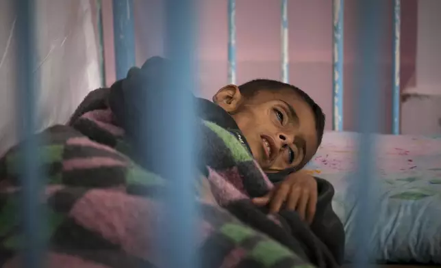 Osama al-Raqab, 5, whose mother says his cystic fibrosis has worsened since the start of the war due to the lack of meat, fish and enzyme tablets to help him digest food, is being treated at the malnutrition clinic in Nasser hospital, Khan Younis, Gaza, on Thursday, May 1, 2025. (AP Photo/Abdel Kareem Hana)