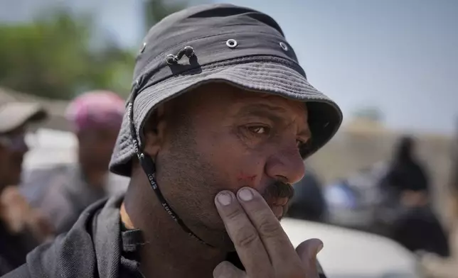 Jamil Atili, 51, shows a knife cut across his cheek, which he says he suffered amid the scramble for food at a distribution center run by private contractor the Gaza Humanitarian Foundation in the southern Gaza Strip, as he arrives empty-handed in Khan Younis, Wednesday, June 11, 2025. (AP Photo/Abdel Kareem Hana)