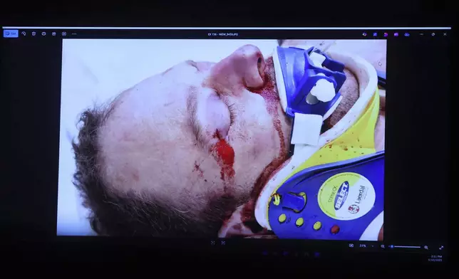 EDS NOTE: GRAPHIC CONTENT - An autopsy photo of deceased Boston Police Officer John O'Keefe is displayed during the Karen Read retrial, Tuesday, June 10, 2025, in Dedham, Mass. (Matt Stone /The Boston Herald via AP, Pool)