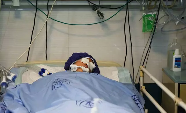 Parnia Rahmanian, 13, lies unconscious in a hospital bed following Israeli strike that targeted her neighborhood, in Tehran, Iran, Saturday, June 21, 2025. (AP Photo/Vahid Salemi)