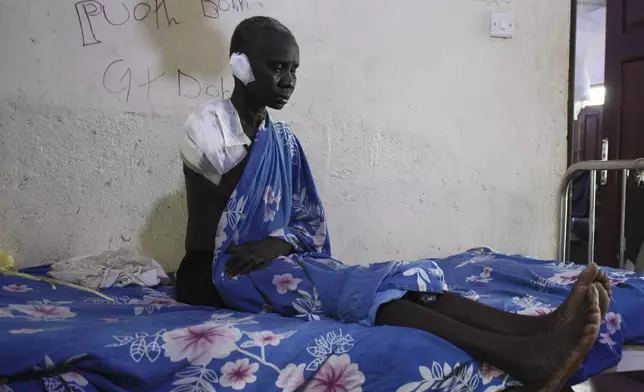 Wiyuach Makuach, 60, who lost her arm in an airstrike on a hospital operated by Doctors Without Borders (MSF), sits in a hospital bed in Akobo, South Sudan, Sunday, May 25, 2025. (AP Photo/Joseph Falzetta)