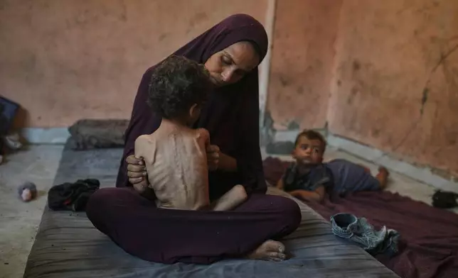 Naima Abu Ful poses for a photo with her 2-year-old malnourished child, Yazan, at their home in the Shati refugee camp in Gaza City, Wednesday, July 23, 2025. (AP Photo/Jehad Alshrafi)