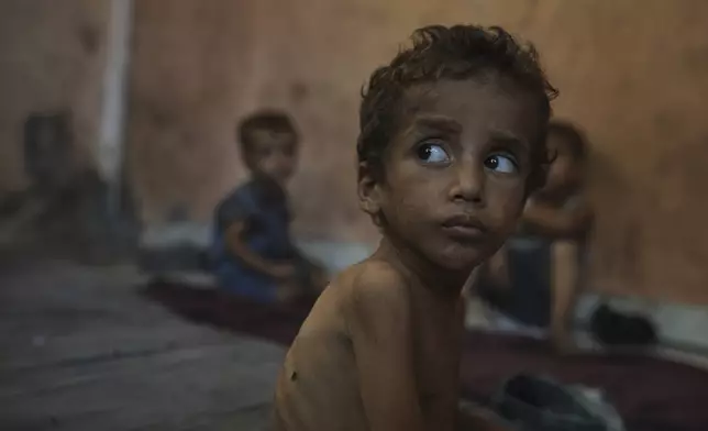 Yazan Abu Ful, a 2-year-old malnourished child, sits at his family home in the Shati refugee camp in Gaza City on Wednesday, July 23, 2025. (AP Photo/Jehad Alshrafi)