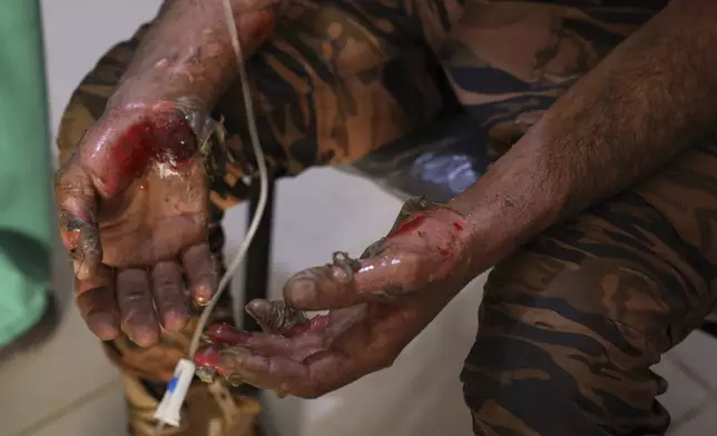 A soldier injured in Sweida city during clashes between government forces and Druze militias, waits for treatment at a clinic in Busra al-Harir village, southern Syria, Tuesday, July 15, 2025. (AP Photo/Omar Albam)
