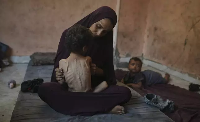 Naima Abu Ful holds her malnourished 2-year-old child, Yazan, at their home in the Shati refugee camp in Gaza City on Wednesday, July 23, 2025. (AP Photo/Jehad Alshrafi)