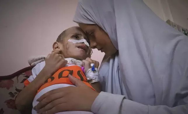 Nour al-Hams holds her 3-year-old nephew, Amr al-Hams, who lies in a hospital bed with brain damage caused by an Israeli strike on his family's tent in April, at Nasser Hospital in Khan Younis, Gaza Strip, Wednesday, June 25, 2025. (AP Photo/Mariam Dagga)