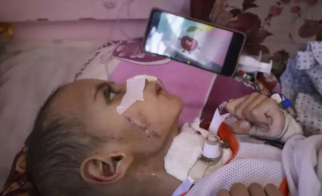 A cartoon is displayed on a phone for 3-year-old Amr al-Hams as he lies in a bed with brain damage caused by by an Israeli army strike on his family's tent in April, at Nasser Hospital in Khan Younis, Gaza Strip, Wednesday, June 25, 2025. (AP Photo/Mariam Dagga)