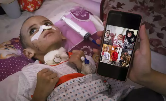 Old photos of 3-year-old Amr al-Hams are displayed on a phone as he lies in a bed with brain damage caused by an Israeli army strike on his family's tent in April, at Nasser Hospital in Khan Younis, Gaza Strip, Friday, July 4, 2025. (AP Photo/Mariam Dagga)