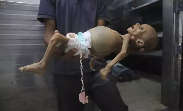EDS NOTE: GRAPHIC CONTENT - A morgue worker shows journalists the body of 5-month-old baby, Zainab Abu Halib, who died from malnutrition-related causes, according to Dr. Ahmed al-Farah, head of the pediatric department at Nasser Hospital, before her funeral, in Khan Younis, Gaza Strip, Saturday, July 26, 2025. (AP Photo/Mariam Dagga)