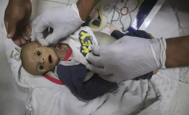 EDS NOTE: GRAPHIC CONTENT - A morgue worker prepares the body of 5-month-old baby, Zainab Abu Halib, who died from malnutrition-related causes, according to Dr. Ahmed al-Farah, head of the pediatric department at Nasser Hospital, before her funeral, in Khan Younis, Gaza Strip, Saturday, July 26, 2025. (AP Photo/Mariam Dagga)