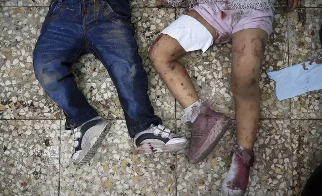 The bodies of two children lie on the hospital floor after an Israeli strike killed 10 people, including two women and five children, while they were waiting to receive nutritional supplements at a Project Hope-run medical clinic in Deir al-Balah, Gaza Strip, Thursday, July 10, 2025. (AP Photo/Abdel Kareem Hana)