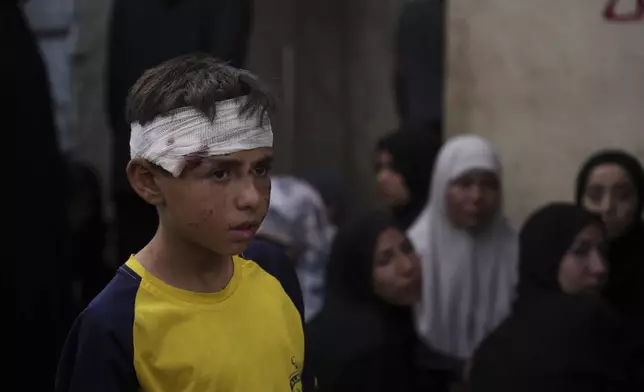 Ali Al-Aimawi attends the funeral of his relatives, who were killed in an Israeli bombardment of Al-Zawaideh, a strike in which he was also injured, at the morgue of Al-Aqsa Hospital in Deir al-Balah, Gaza Strip, on Tuesday, July 1, 2025. (AP Photo/Abdel Kareem Hana)