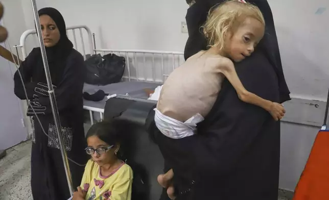 Islam Qudeih holds her severely malnourished shirtless, 2-year-old daughter, Shamm, at Nasser Hospital in Khan Younis, southern Gaza Strip, Saturday, Aug. 9, 2025. Doctors said Shamm may have a genetic disorder that affects muscle and bone development, but there is no way to test for it in Gaza. On Tuesday, August 12, her family was granted permission to travel to a hospital in Italy. (AP Photo/Mariam Dagga)