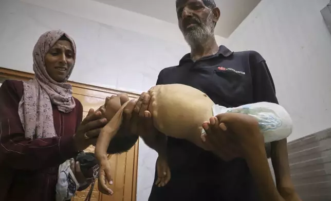 Islam Al-Najjar caresses the body of her 5-year-old nephew, Jamal al-Najjar, as his grandfather, Adnan Al-Najjar, carries him to be prepared for his funeral after he died at Nasser Hospital in Khan Younis, southern Gaza Strip, Tuesday, Aug. 12, 2025. The head of Nasser's pediatrics unit said Jamal, who was born with rickets, died from severe malnutrition. (AP Photo/Mariam Dagga)