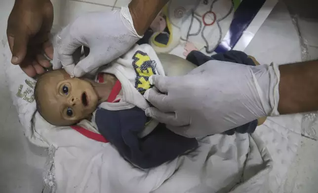 EDS NOTE: GRAPHIC CONTENT - A morgue worker prepares the body of 5-month-old baby, Zainab Abu Halib, who died from malnutrition-related causes, according to Dr. Ahmed al-Farah, head of the pediatric department at Nasser Hospital, before her funeral in Khan Younis, Gaza Strip, July 26, 2025. (AP Photo/Mariam Dagga)