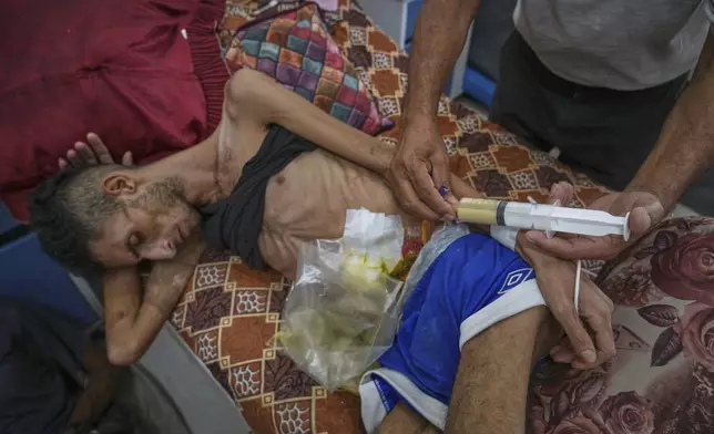 Atef Arhouma feeds his injured son, Karam Arhouma, 22, lentil soup through a syringe at Shifa Hospital, where doctors say he is showing signs of malnutrition, in Gaza City, Monday, Aug. 18, 2025. (AP Photo/Abdel Kareem Hana)