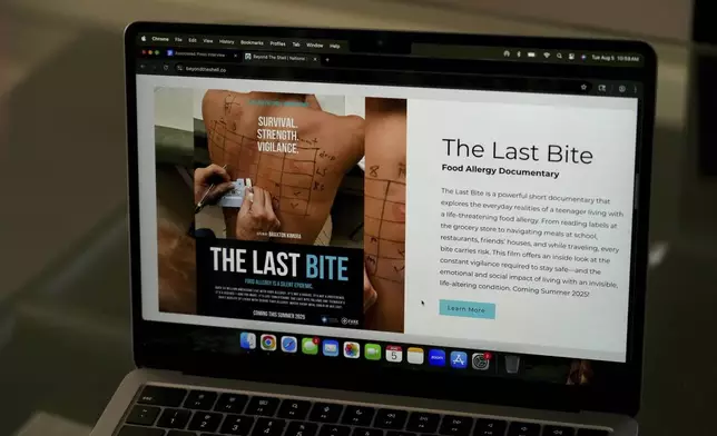 Braxton Kimura watches a food allergy documentary on Wednesday, Aug. 13, 2025, in San Jose, Calif. (AP Photo/Terry Chea)